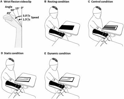 Differential Effect of Visual and Proprioceptive Stimulation on Corticospinal Output for Reciprocal Muscles